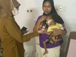 Kurus dan Lemas, Warga Gelumbang di Duga Kurang Gizi