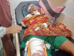 Warga Kepur Tertabrak Kereta Selamat, Tangan Diamputasi