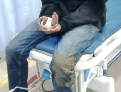 Remaja Diserang Kelompok Tak Dikenal, YZ Lapor Polisi