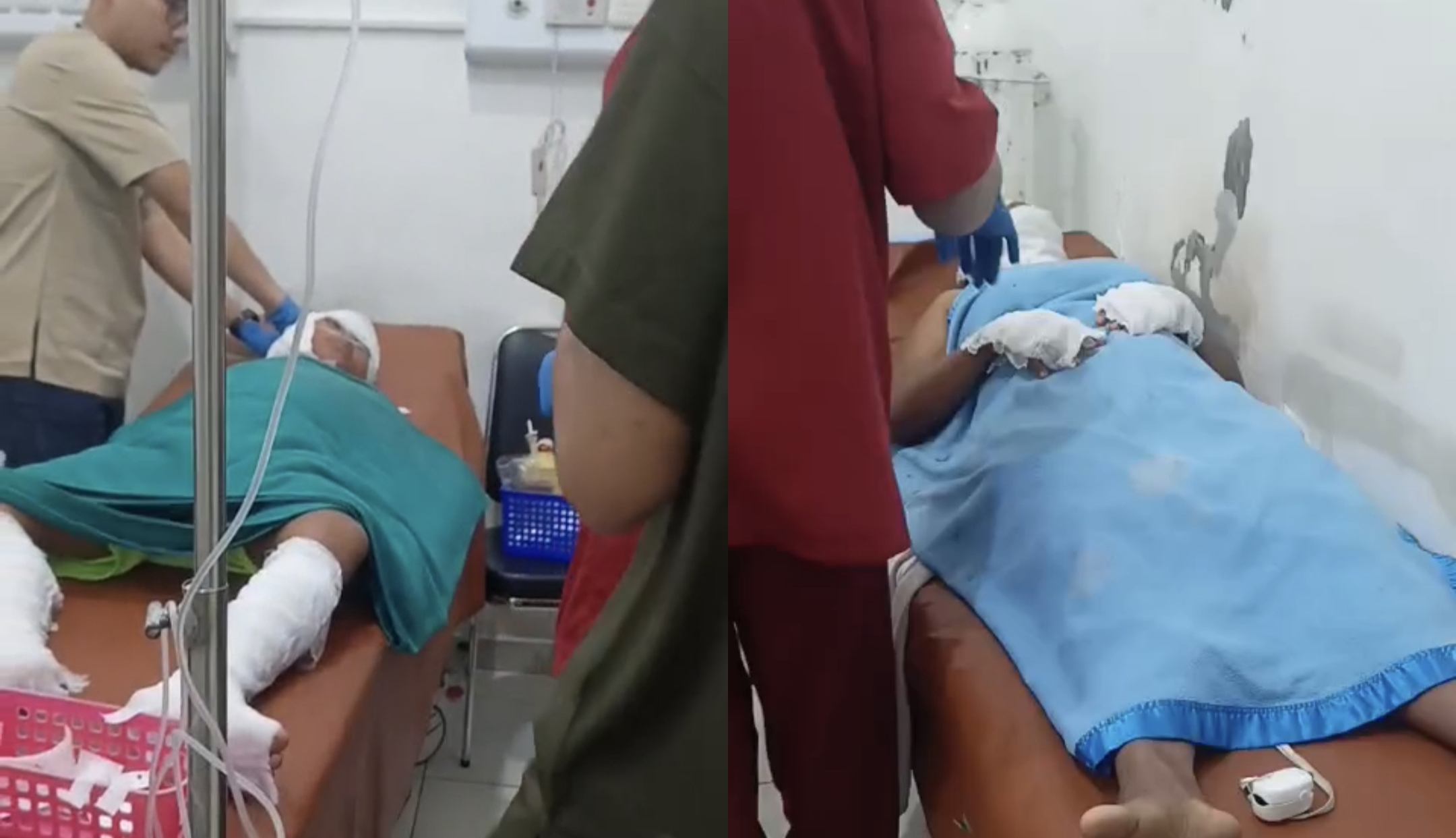 Petugas medis menangani tiga korban luka bakar akibat insiden api terbuka di area pipa gas Pertamina EP Prabumulih di Desa Gunung Raja, Kabupaten Muara Enim, sebelum dirujuk ke rumah sakit di Palembang.